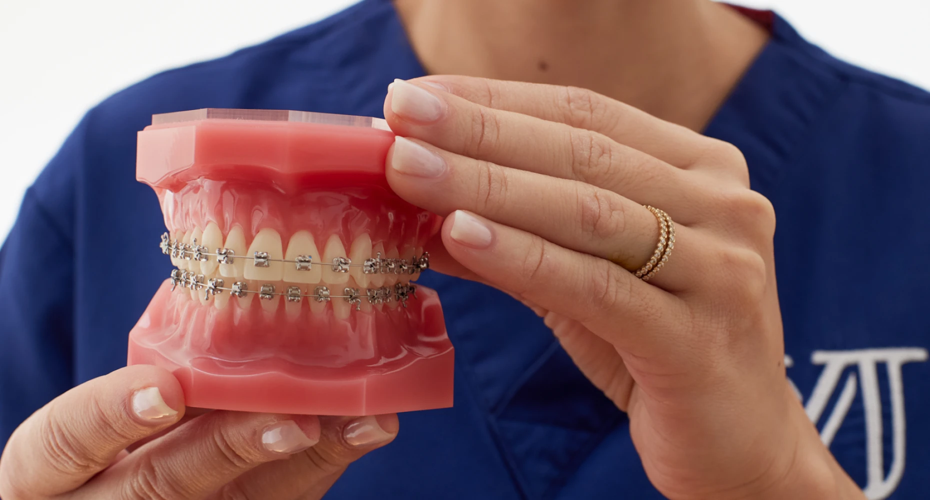 Multi-attaches au cabinet d'orthodontie du Dr Janssens à Paris 16