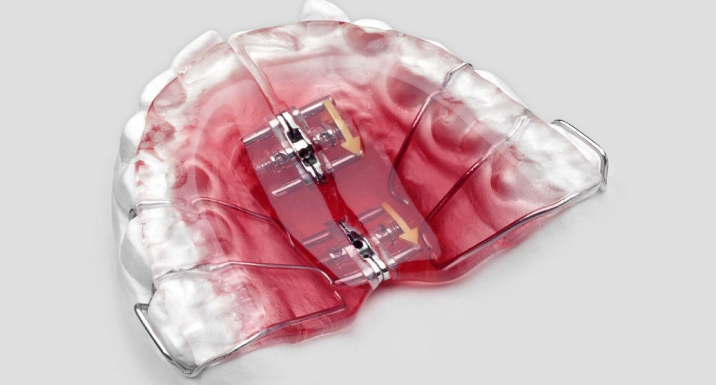 Orthodontiste enfants Paris 16